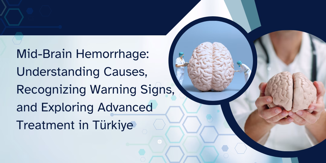 Mid-Brain Hemorrhage: Understanding Causes, Recognizing Warning Signs, and Exploring Advanced Treatment in Türkiye