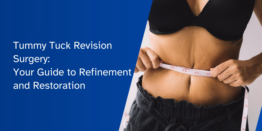 Tummy Tuck Revision Surgery: Your Guide to Refinement and Restoration